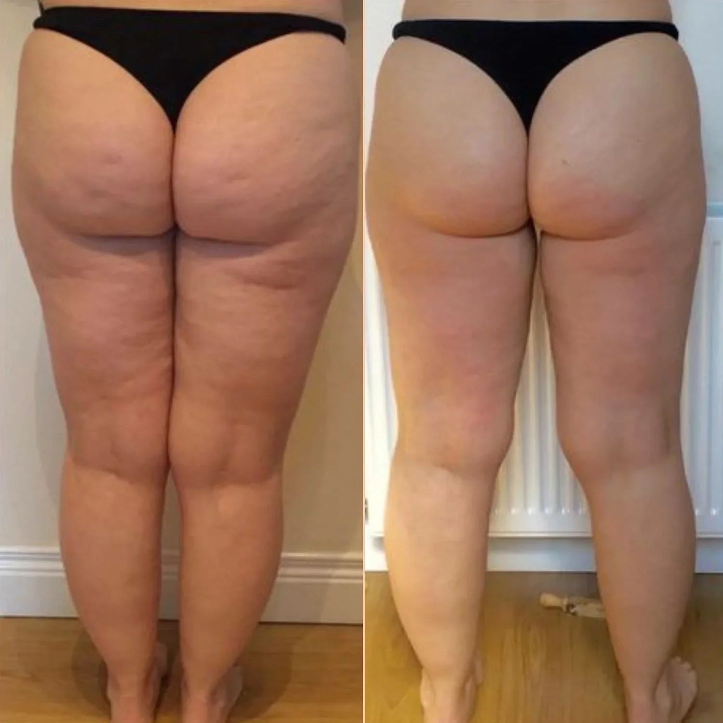 Anti cellulite oil collagen plant stem cells  2 .0