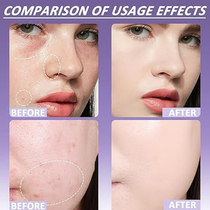 🎉Hot Sale Special Price ONLY $24.99🔥Soft Matte Cream Concealer