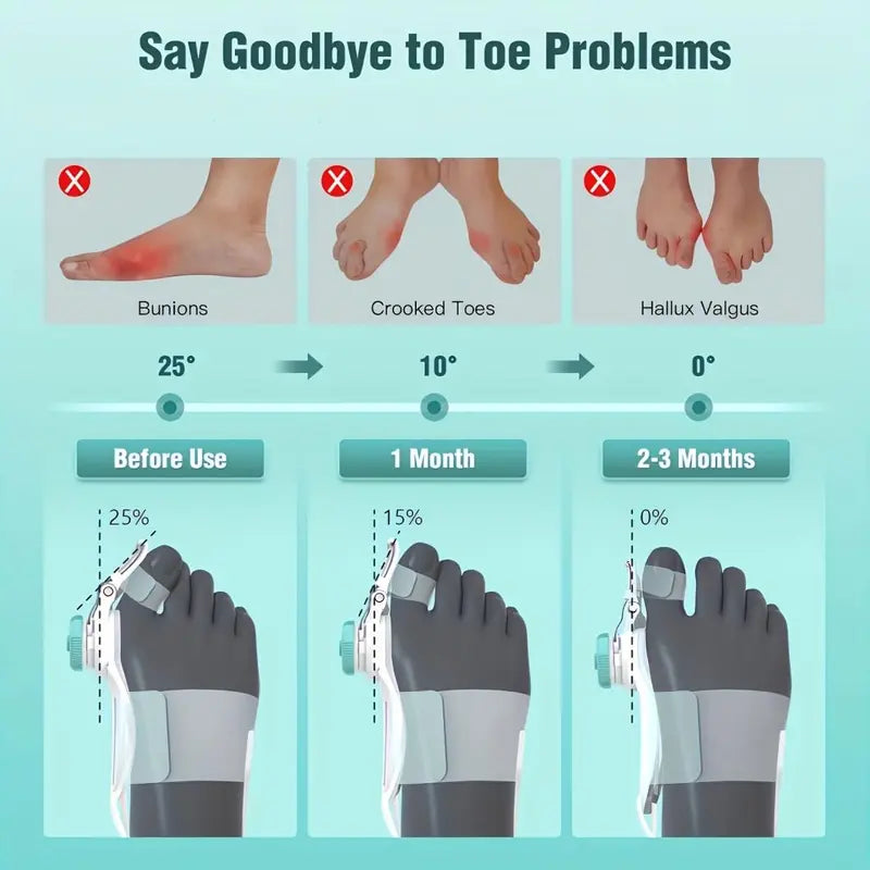 [Big Toe Straightener] Comfortable correction, effortless walking — gently supporting your every step 👣