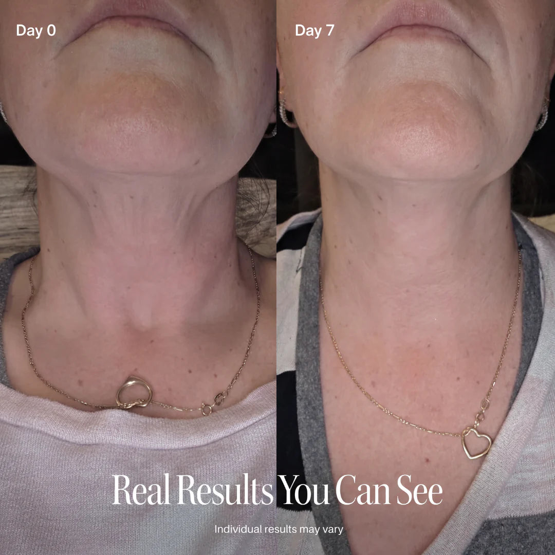 ✨ LAST DAY BUY 1 GET 1 FREE✨CELESTVÉRA Face Slimming Cream