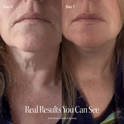 ✨ LAST DAY BUY 1 GET 1 FREE✨CELESTVÉRA Face Slimming Cream