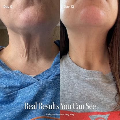 ✨ LAST DAY BUY 1 GET 1 FREE✨CELESTVÉRA Face Slimming Cream