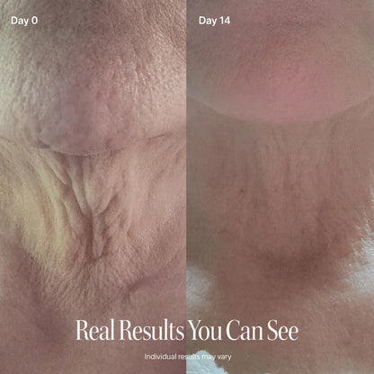 ✨ LAST DAY BUY 1 GET 1 FREE✨CELESTVÉRA Face Slimming Cream