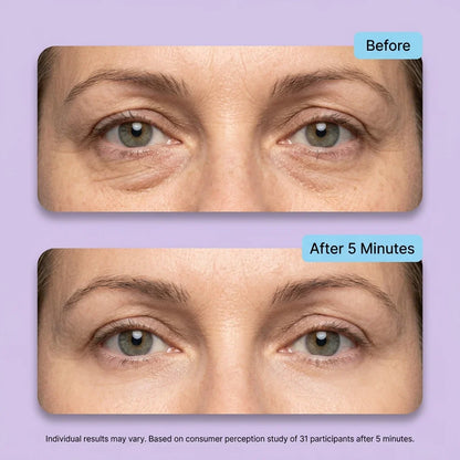 Instant Lift Eye Gel