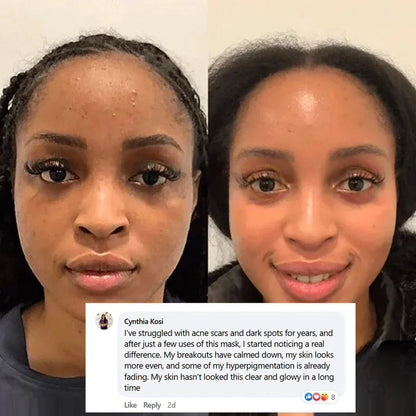 Pamper Yourself — Buy 2 Collagen Night Masks, Get 1 Free! Wake Up to Youthful, Hydrated Skin!